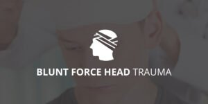Blunt Force Head Trauma | Great Trial Law